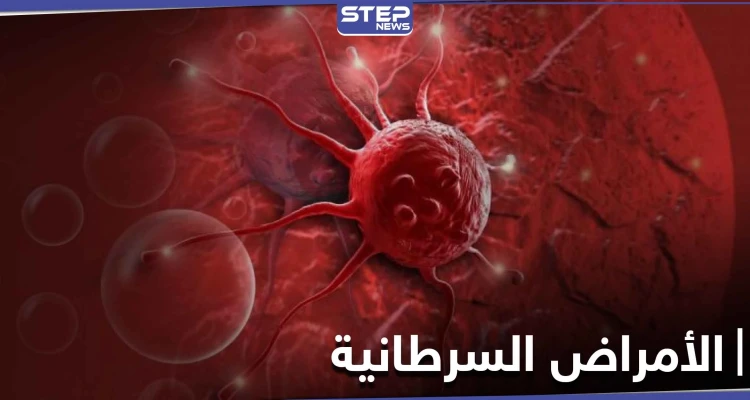 نصائح هامة عليك معرفتها.. لتجنب الإصابة بالأمراض السرطانية القاتلة