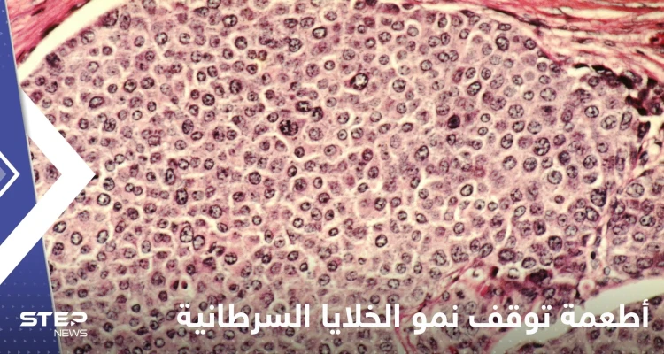 علماء يكتشفون أطعمة توقف نمو الخلايا السرطانية في الجسم وتمنع انتشارها