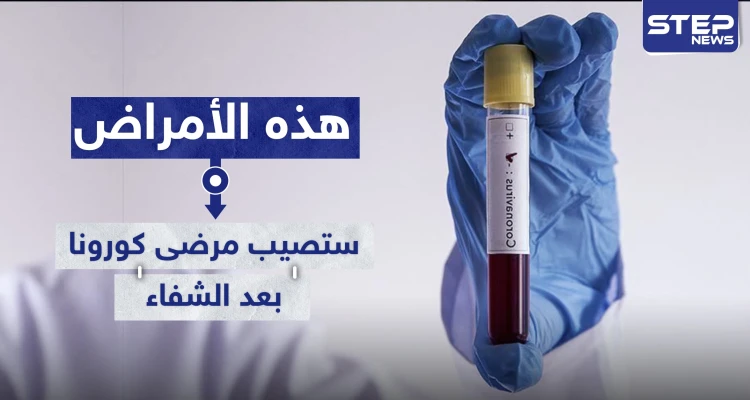 دراسة تكشف الأمراض التي ستصيب مرضى "كورونا" بعد الشفاء من الفيروس