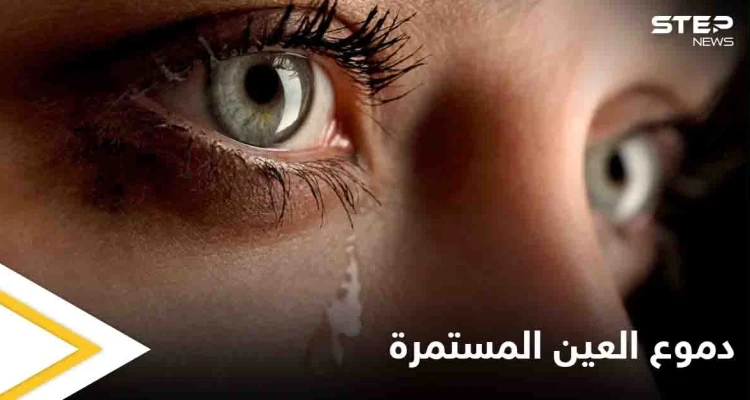 تعرف على أسباب دموع العين المستمرة وطرق علاجها