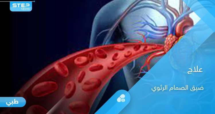 خطورة ضيق الصمام الرئوي وطرق العلاج.. إليك أهم المعلومات