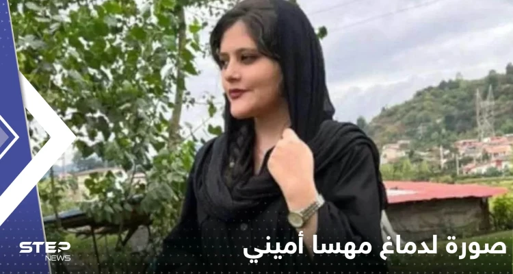 شاهد|| صورة لدماغ مهسا أميني تكشف تفاصيل ما حدث.. وعرض وجوه الجناة لأول مرة