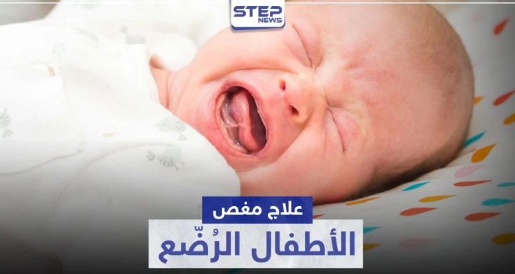 أفضل طرق علاج مغص الأطفال الرضع.. وما هي أعراضه وأسبابه