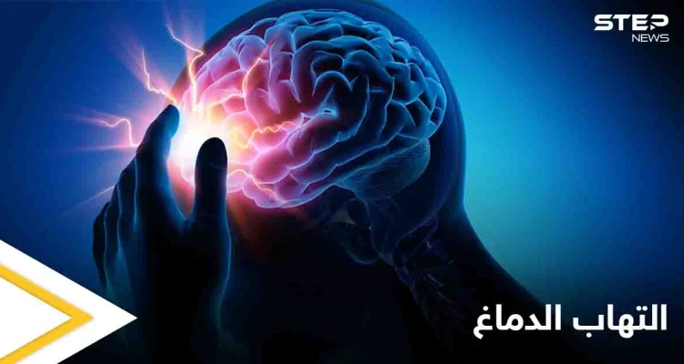تعرف على مرض التهاب الدماغ ومخاطره الصحية وكيفية الوقاية منه