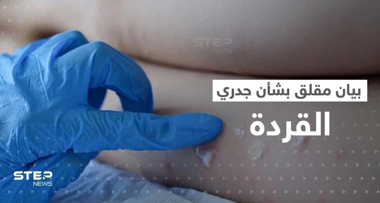 جدري القردة حالة طوارئ دولية.. الصحة العالمية تصدر بياناً "مثيراً للقلق"