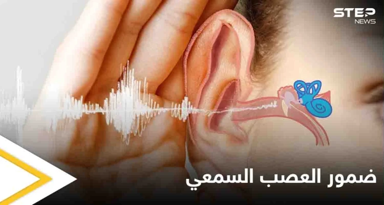 تعرف على مرض ضمور العصب السمعي أسبابه وأعراضه وطرق العلاج