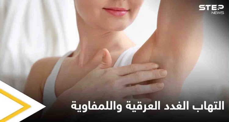 تعرف على أسباب التهاب الغدد العرقية واللمفاوية والفرق بينهما