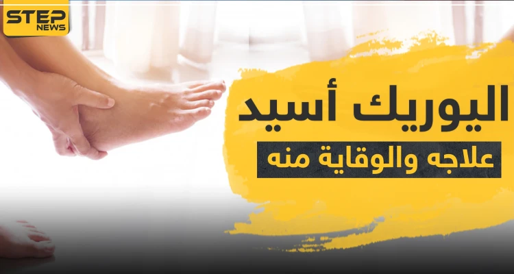 أدوية علاج اليوريك أسيد وطرق الوقاية منه