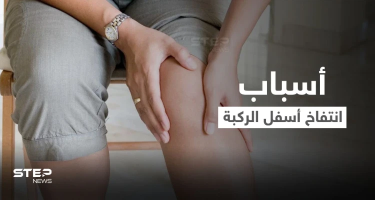 تعرف على أسباب انتفاخ أسفل الركبة وطرق العلاج