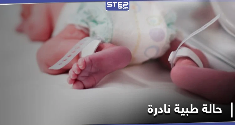 حالة طبية نادرة في بريطانيا.. أم تلد ثلاثة أطفال من رحمين مختلفين في آن واحد