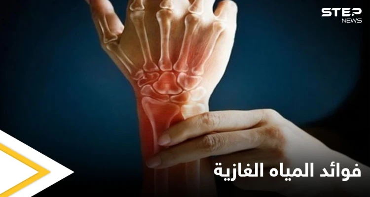 منها تعزيز صحة العظام.. تعرف على فوائد المياه الغازية ومضارها الجانبية