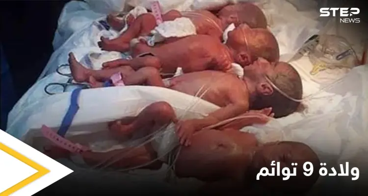 شاهد بالصور|| في حالة نادرة.. ولادة 9 أطفال من أم واحدة تتطلب تدخل السلطات: أخبار