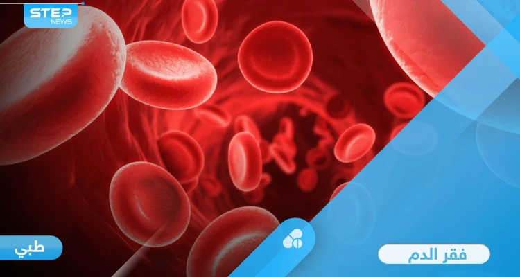 ما هو فقر الدم وأهم الأسباب المؤدية إليه وأبرز طرق العلاج إليك أهم المعلومات