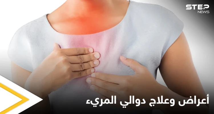 ما هي دوالي المريء وأعراضها وطرق علاجها إليك أهم المعلومات