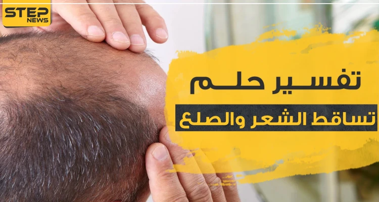 تفسير حلم تساقط الشعر والصلع بحسب ابن سيرين للحامل والمتزوجة والعزباء