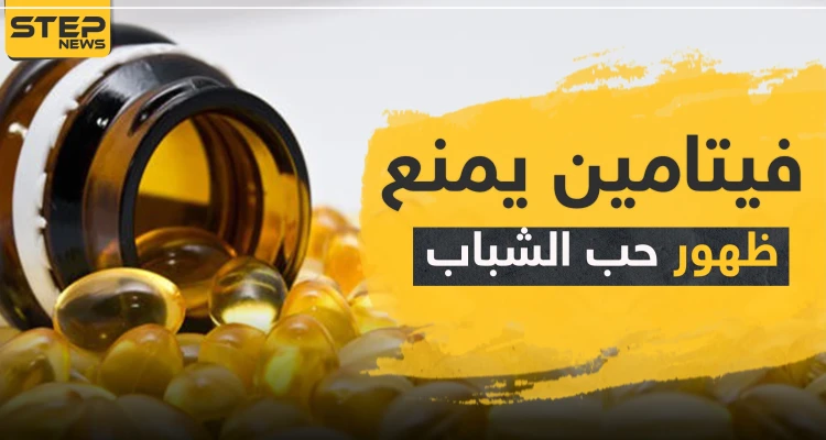إذا كنت تعاني منها.. فيتامين يمنع ظهور حب الشباب