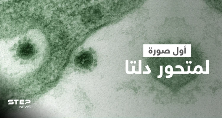 شاهد مجهر إلكتروني يلتقط أول صورة لـ متحور دلتا ينمو كخلايا القرد الأفريقي (صورة)