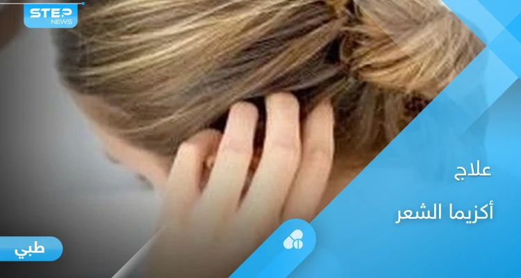 علاج أكزيما الشعر الدهنية بالأعشاب والنظام الغذائي المناسب لها