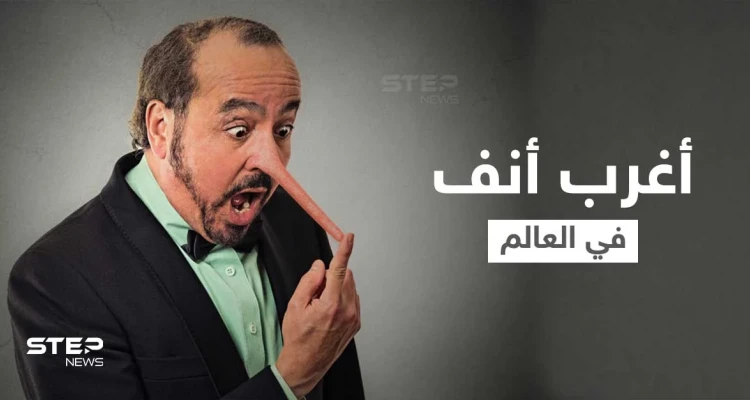 شاهد|| "أرسل الله ملاكاً للاعتناء بي".. صاحب أغرب أنف في العالم يكشف كيف عاد شكل وجهه لطبيعته