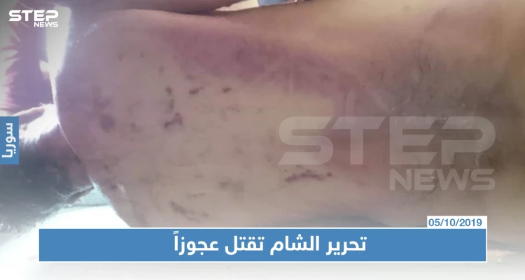 بالصور: مقتل رجل تحت التعذيب بسجون هيئة تحرير الشام