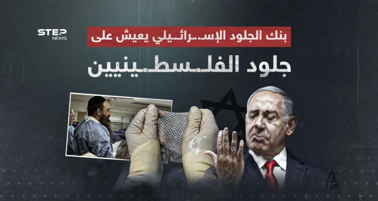 أثار الجدل في وسط حرب غـ..ـزة… ما هو بنك الجلد الإسرائيلي