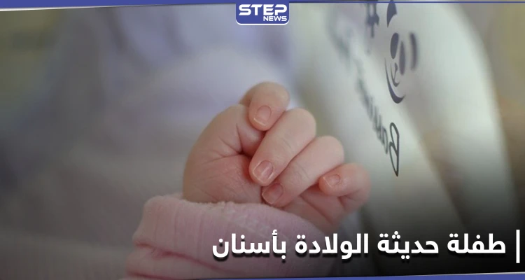 شاهد|| طفلة حديثة الولادة تملك أسناناً.. حالة طبية نادرة في مصر