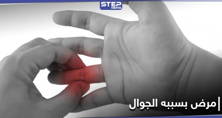 فرط استخدام الهاتف المحمول قد يسبب التهاب مفاصل الأصابع.. إليك طريقة تفاديه