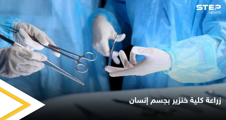 تجارة الأعضاء البشرية إلى زوال بعد نجاح زراعة كلية خنزير في جسم إنسان لأول مرة في التاريخ