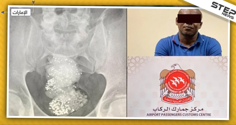 السلطات الإماراتية تلقي القبض على "مهرّب" أخفى الألماس في أحشائه