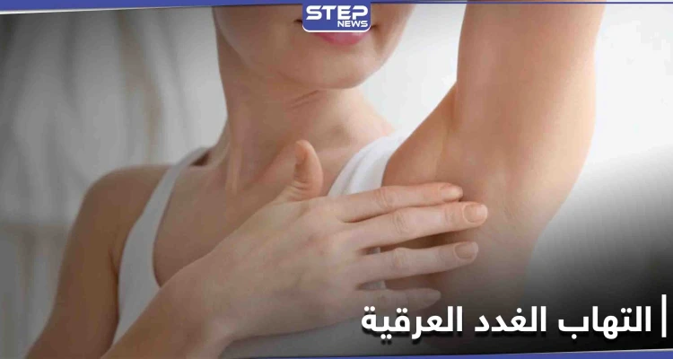 متى يحتاج التهاب الغدد العرقية إلى الجراحة تعرف إلى أعراضه وطرق العلاج