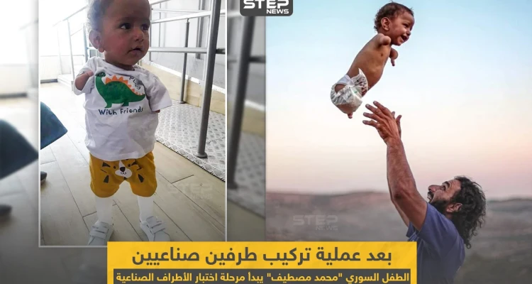 الطفل السوري "محمد مصطيف" بعد عملية تركيب طرفين صناعيين له
