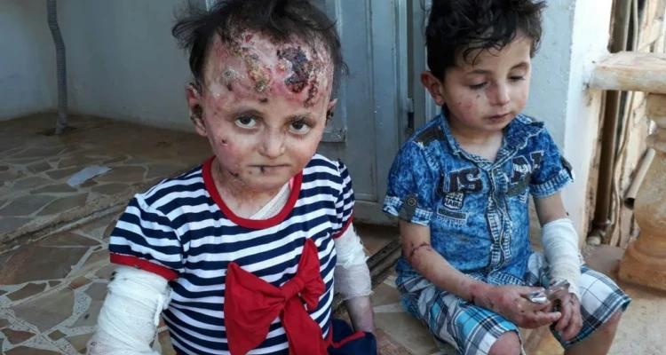 مرض نادر يفتك بطفلين شمالي حلب، ووالدهما يُناشد: أخبار