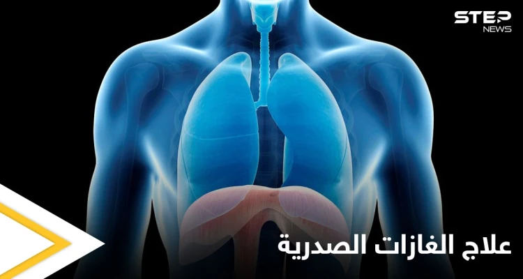 علاج الغازات الصدرية في المنزل وعلاقتها بآلام القلب إليك أهم المعلومات