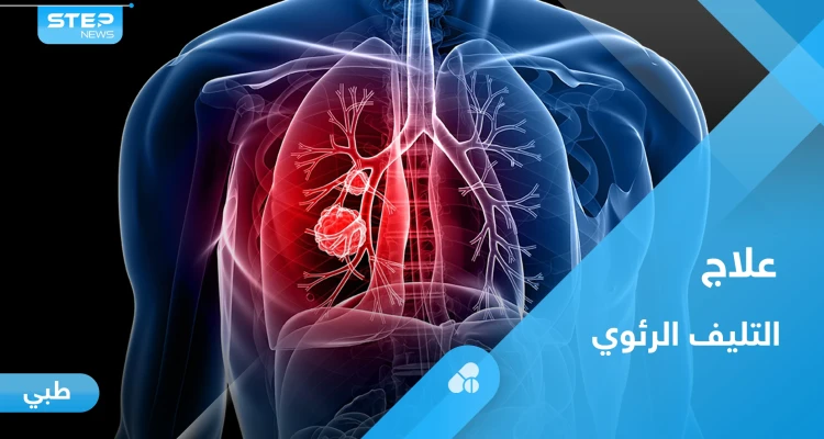 ما هو التليف الرئوي.. تعرف على أعراضه و أبرز طرق العلاج