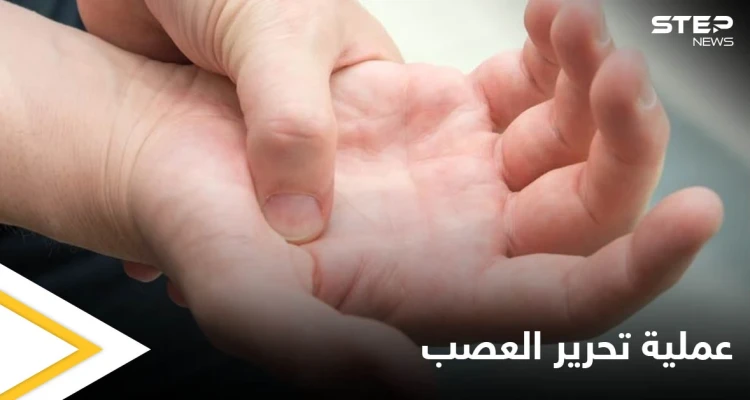 عملية تحرير العصب.. متى يجب إجراؤها وأنواعها إليك أهم المعلومات