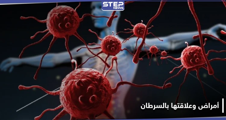 أمراض تسبب تطور السرطان ويمكن أن تسبب في نشأته.. فأحذرها وحاول معالجتها فوراً