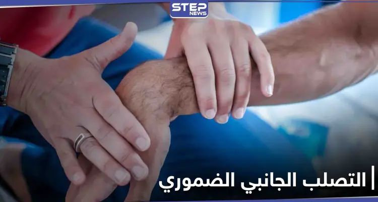 ماهو التصلب الجانبي الضموري وتأثيره على الدماغ إليك كافة التفاصيل: أخبار