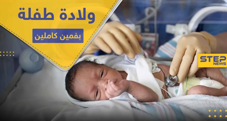 شاهد|| ولادة طفلة بفمين كاملين في حالة طبية نادرة