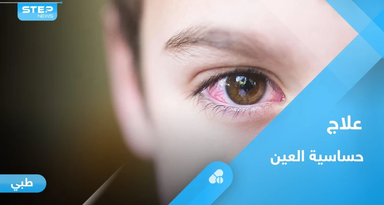 تعرف على علاج حساسية العين عند الاطفال بطرق مختلفة