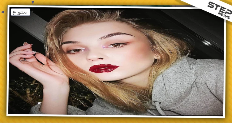 صور || "شفاه الأخطبوط" موضة جديدة في جراحة التجميل للفتيات