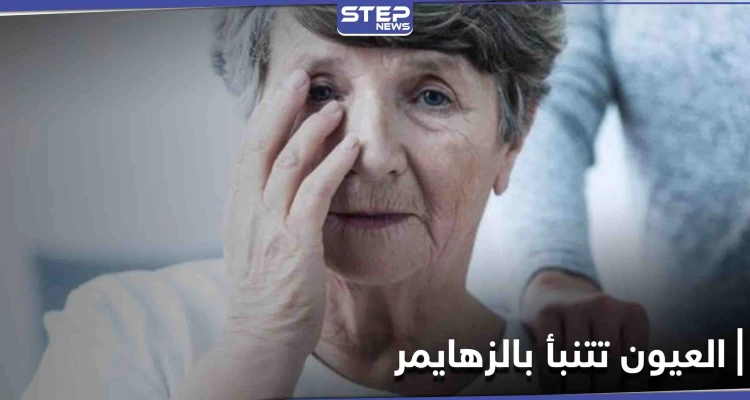 كيف تقدم العيون تنبؤات بحدوث مرض الزهايمر وما هي أبرز الإشارات