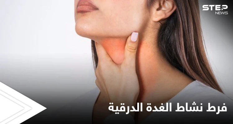أهم الأعشاب لعلاج فرط نشاط الغدة الدرقية تعرف عليها