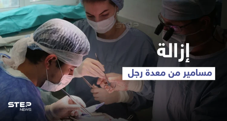 عملية جراحية معقدة لرجل ابتلع المسامير والبراغي لشهر كامل والسبب الكحول (صورة)