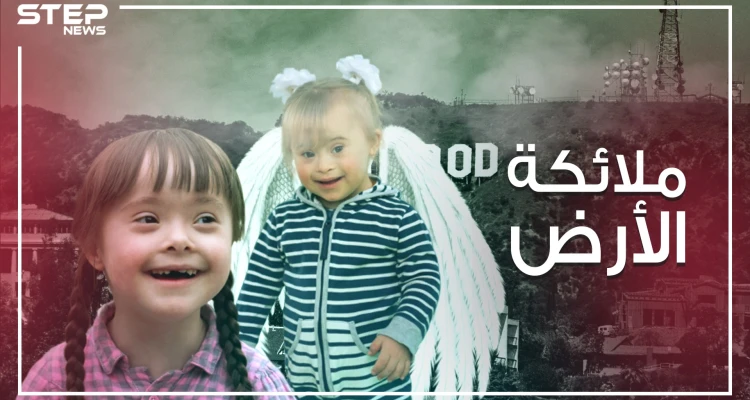 ليسوا منغوليين ..طفرة جينية نتج عنها هذا الشكل ..متلازمة داون الأسباب والتفاصيل