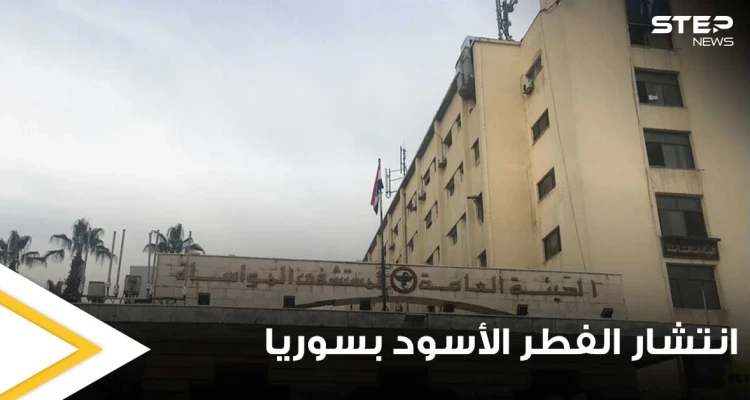 وسط ازدياد حالات الإصابة.. مدير إحدى المستشفيات السورية يكشف سبب زياة انتشار الفطر الأسود