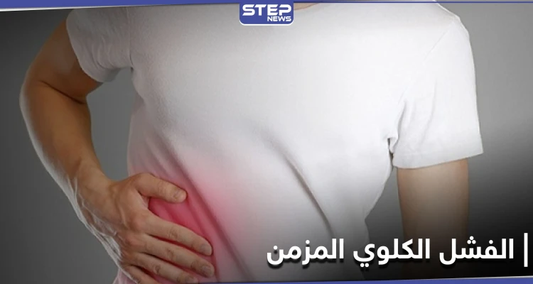 تعرف على مرض الفشل الكلوي المزمن وعلاقة زيادة الوزن به