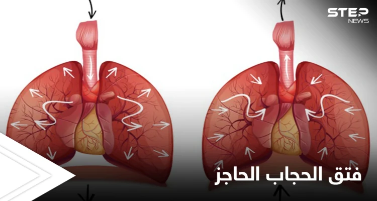 ما هي وظيفة الحجاب الحاجز وكيف يتم علاجه عن طريق العمل الجراحي إليك أهم المعلومات