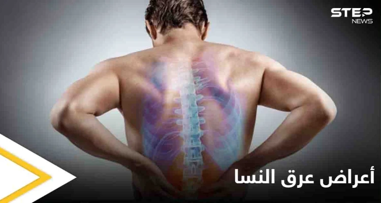 5 أعراض تخبرك بأنك مصاب بمرض عرق النسا تعرف عليها