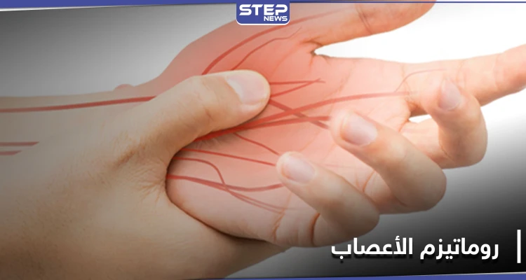 ما هو مرض روماتيزم الأعصاب.. أعراضه الــ"9" وطرق علاجه