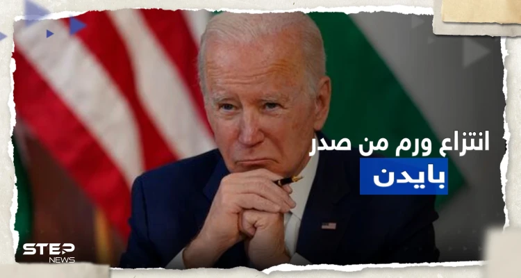 إزالة "ورم جلدي" من صدر بايدن وطبيبه يكشف 3 أمراض يعاني منها